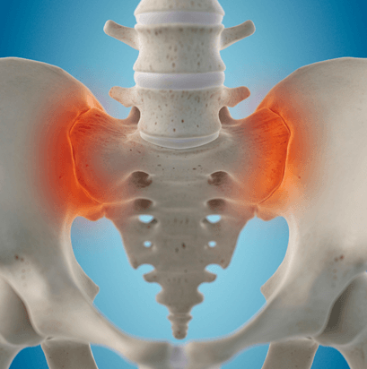 SI Joint Pain, Carrollton